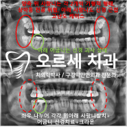 강남역 사랑니 통증, 후유증 걱정 안하게 발치해주는 치과 확인!