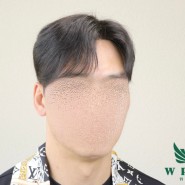 대구 위풍당당의 40대 남자맞춤가발 스타일 추천!