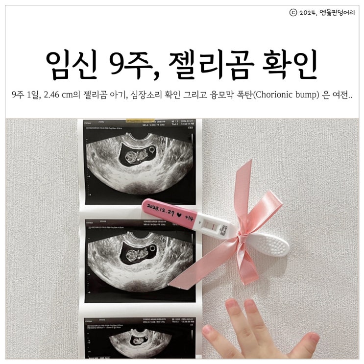 임신 9주 1일 / 젤리곰, 심장소리 확인, 여전히 보이는 융모막 폭탄, 돌기(Chorionic bump) : 네이버 블로그