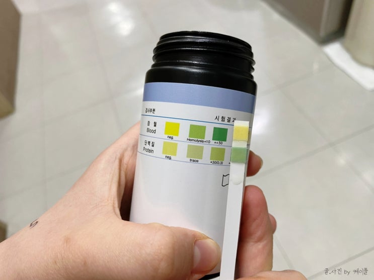 요단백 양성 원인 단백뇨 거품 : 네이버 블로그
