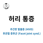 허리 통증 / 요추 추간판 탈출증 (HIVD) / 후관절 증후군 (Facet joint syndrome) 증상 및 치료