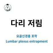 다리 저림 / 요골신경총 포착 (Lumbar plexus entrapment) 치료