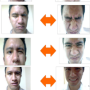 [윈백(WINBACK) 논문] 라디오프리퀀시 VS 파라딕 전류: 말초성 얼굴 마비 환자의 기능적 재활