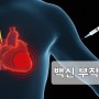 중앙일보] 1억명 조사 충격적 부작용…코로나 백신 ‘척수’ 건드렸다