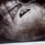 임신7주차 확인한 후 강남구 보건소 혜택 뭐가 있을까?