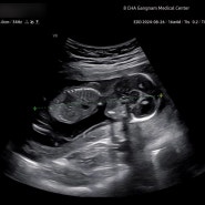부부일기 - 임신 편 #3 (임신 초중기 13주~16주)