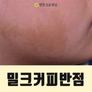 밀크커피색반점 치료기간은 얼마나 걸릴까요? [명동역피부과 - 고운세상]