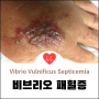 비브리오 패혈증(Vibrio Vulnificus Septicemia) 원인 설명, Vibrio Sepsis 원인과 증상 진단, 세팔로스포린 테트라사이클린 등 약물 치료와 예방법