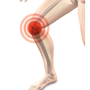 [윈백(winback)] 무릎 관절염, 무릎 주변통증과 부종을 치료하는 윈백(WINBACK) 고주파 테카(TECAR)에너지와 다중 주파수(Multi-Frequency)