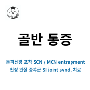 골반 통증 / 천장관절 증후군 (SI joint syndrome) / 상둔피신경 (SCN) / 중둔피신경 (MCN) 포착 치료