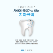 구미치과 치아금감, 치아크랙 증상은?