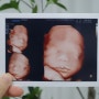 [임신 27주] 태아 3D 입체 초음파 검사(시기 시간 얼굴 사진 가격 비용)