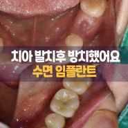 '타지에서 발치한 치아, 방치해둔 후 재치료' 인계동 수면치료 치과 의식하진정요법