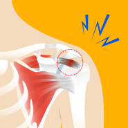 부천어깨충돌증후군병원, 팔 올릴 때 통증, 치료 방법은?