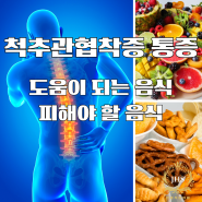 척추관협착증 통증에 도움이 되는 음식과 피해야 할 음식