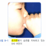 손가락 빨기(Finger sucking) / 바라던 치과 / 청라 치과