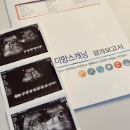 2차기형아검사_임신16주/초음파/혈액검사/성별확인