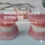 청소년 치아교정 관리의 중요성과 고정식 브라켓 교정&인비절라인 투명 치아 교정 양치하는 방법