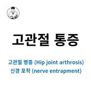 고관절 통증 / 고관절 병증 (Hip joint arthrosis) / 신경포착 증후군 (nerve entrapment) 치료법