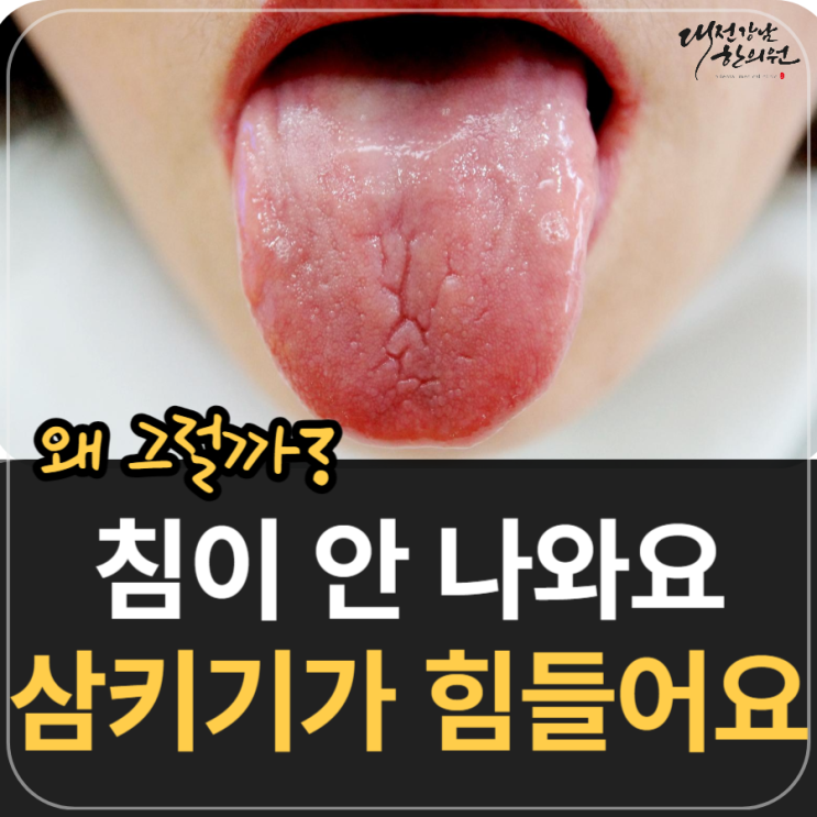 침이 안 나와요, 삼키기 힘들어요 : 구강건조증과 위축성설염 : 네이버 블로그