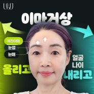 이마주름제거방법 이마거상이란?