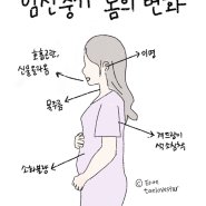 임신일기 ✦ 임신 중기 임산부 몸의 변화 (목주름, 이명, 색소침착, 소화불량, 신물 등)