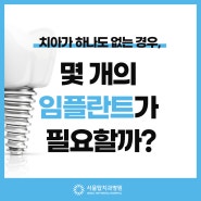 강남 전체임플란트 치아가 하나도 없는 경우, 몇 개의 임플란트가 필요할까[김현종의 백세 건치]