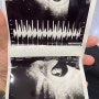 [경산모 임신 7-8주] 아기 심장소리 & 왕 젤리곰 확인 초음파 사진💕