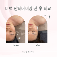 일산 풍산 To 아름 에스테틱 미백 안티에이징 후기