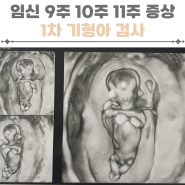 임신9주 임신10주 임신11주 증상 1차 기형아검사