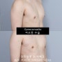 마른 체형 남자 여유증, 수술 후기 및 유두축소 후기 【Dr. 아베크 여유증】
