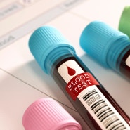 혈액검사로 알 수 있는 남자성병종류에는 어떤 것이 있나요?