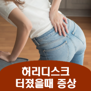 허리디스크 터졌을때 증상, 갑자기 급성 디스크 터졌을때