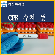 CPK 수치 뜻 높을때 측정방법 정상수치 CPK 약