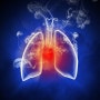 만성 폐쇄성 폐질환(COPD)에 대한 한약치료의 효과