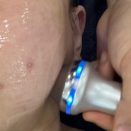 [신림 피부관리]붉은피부진정 물방울리프팅