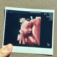 임신 27주 ~ 29주 증상 입체초음파 열달후에 기록