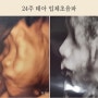 24주 둘째 태아 입체초음파 사진 (첫째랑 비교/ 시기/ 코/ 비용)