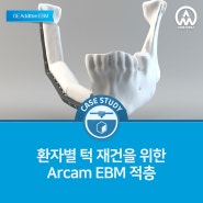 [금속 3D 프린터 활용사례] 환자별 턱 재건을 위한 Arcam EBM 적층