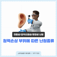 대구보청기 청력 손상 부위에 따른 난청 종류