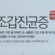 조갑진균증 - 손톱무좀 - 손 발톱무좀치료 방법 - 손발톱무좀약 - 손발톱무좀 예방법