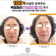 대전 둔산동 보톡스 가격 효과 만족하는 병원 후기 (비포&애프터)