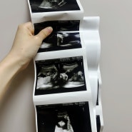 임신일기 ✦ 21주차 정밀초음파, 배 크기, 주수사진 기록