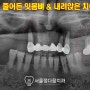 보철과 전문의가 있는 신림역 치과 에서 보험 틀니 및 임플란트로 저작 기능 회복⭐