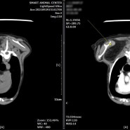 강아지 지방종의 CT 평가 증례