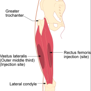 [망포역필라테스/영통필라테스/영통요가/망포동요가원] 외측광근(Vastus Lateralis)의 기능과 역할