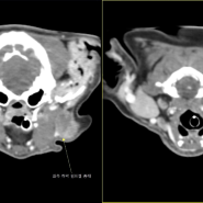 강아지 다발성 림프절 종대의 CT 평가 증례