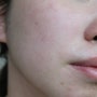 압구정 얼굴윤곽관리 1회 받은 후기 : 강인숙에스테틱