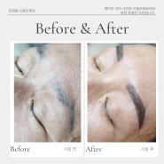 [Brow Work] 푸른잔흔, 붉은잔흔 모두 호원동 오늘모해요에서 눈썹 세미메이크업 커버 받아보세요😘