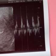 임신 5주 6주 7주 아기(태아) 심장소리 성별 추측 방법